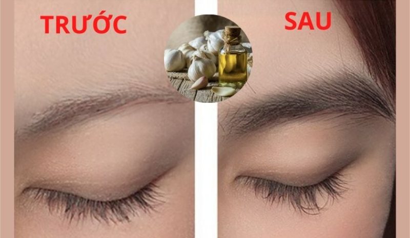 Tìm hiểu về thuốc mọc lông mày